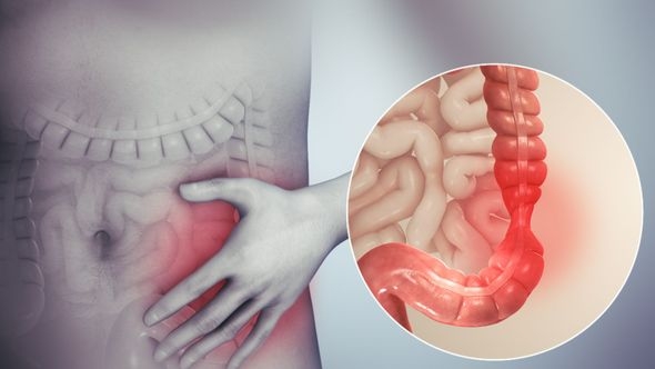 Kako crijevna infekcija može dovesti do zatajenja bubrega